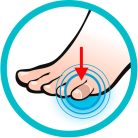Sidas Toe Protector talpbetét